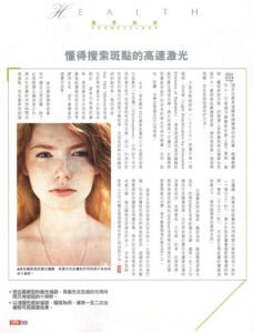 懂得搜索斑點的高速激光