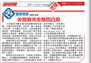 分段激光去除凹凸洞