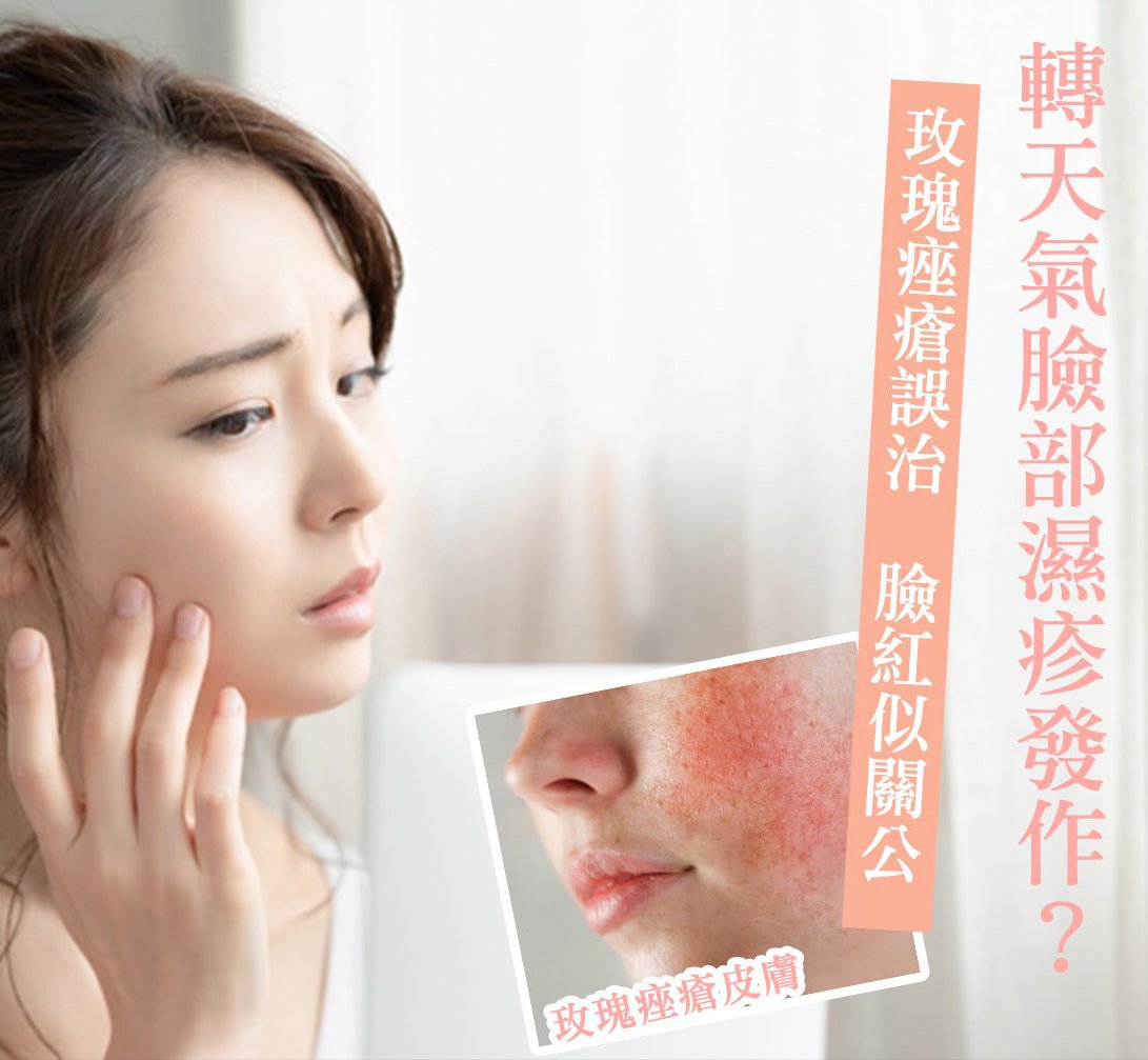玫瑰痤瘡分三階段 耐心治療有效改善