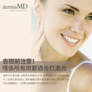 激光去斑, 雀斑, 打斑, 皮秒